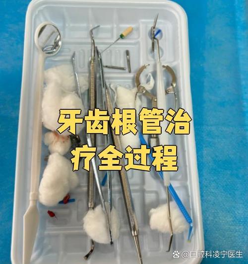 牙齿断掉了只剩根部怎么办游戏截图